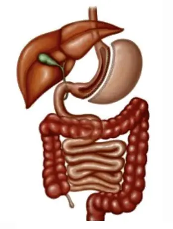 cirurgia bariátrica
obesidade
sleeve
sleeve gástrico
bariátrica